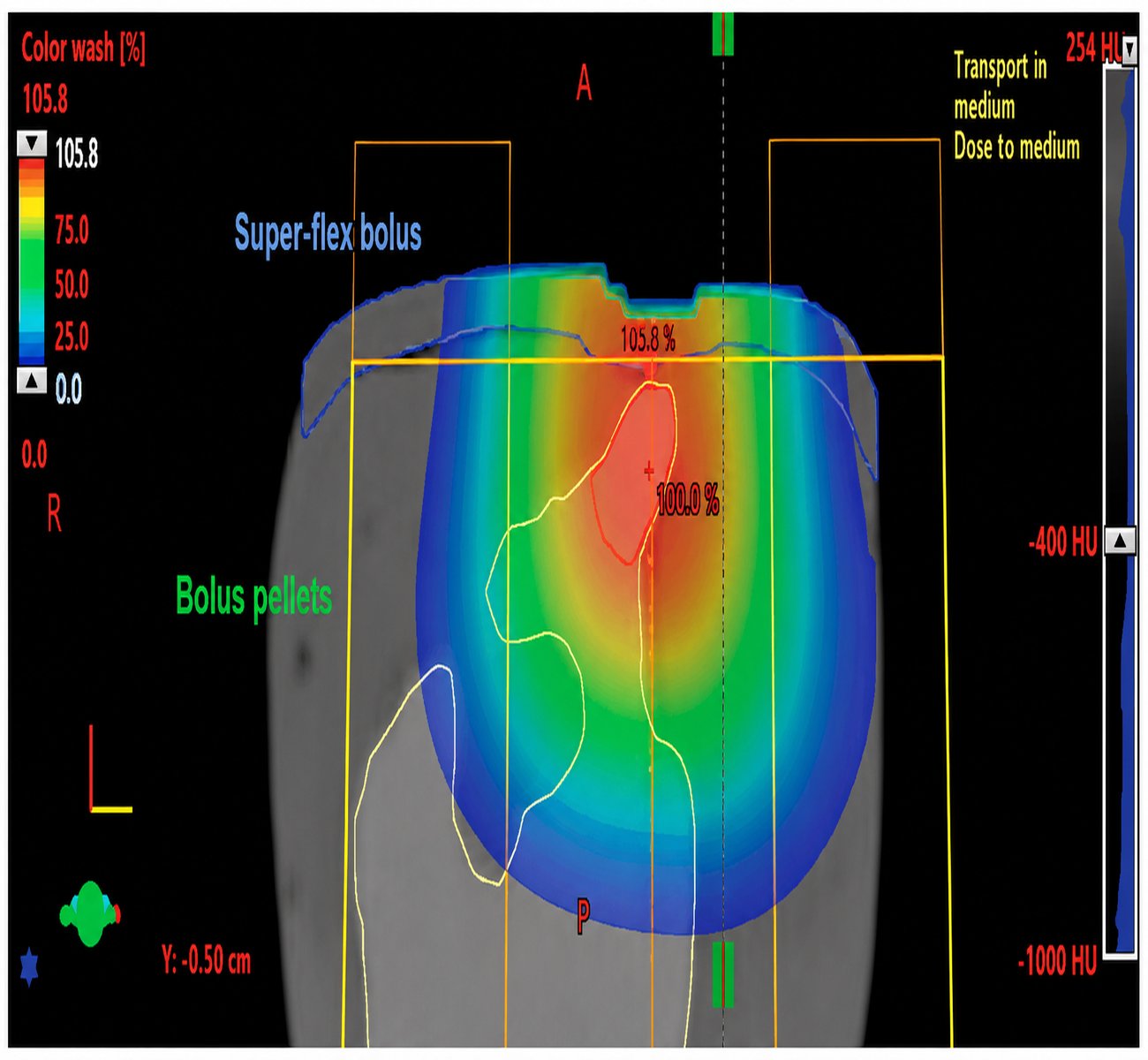 Electron therapy